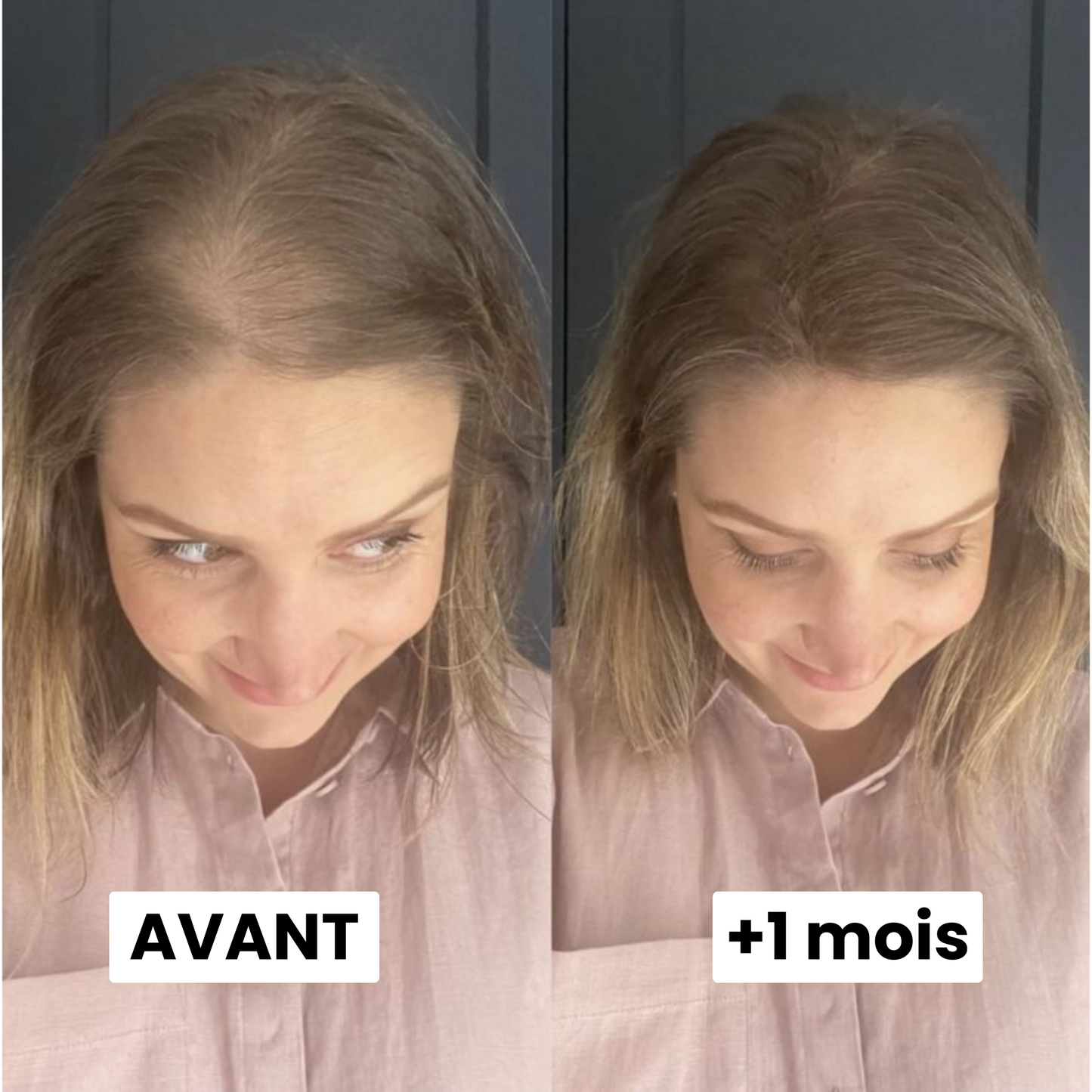 Sérum de Croissance Capillaire Silvora