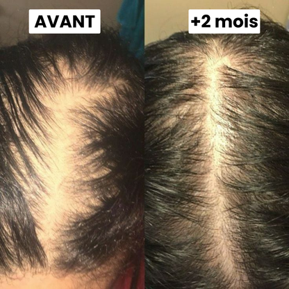 Sérum de Croissance Capillaire Silvora