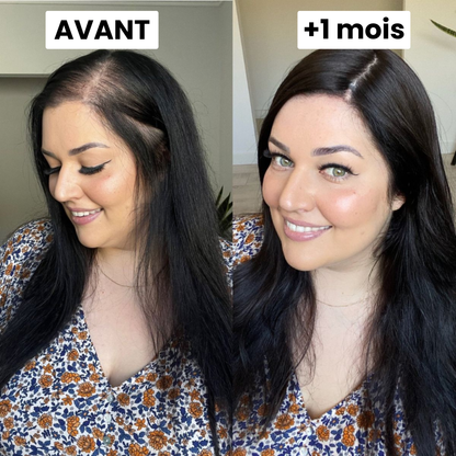 Sérum de Croissance Capillaire Silvora