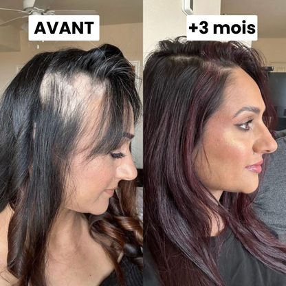 Sérum de Croissance Capillaire Silvora